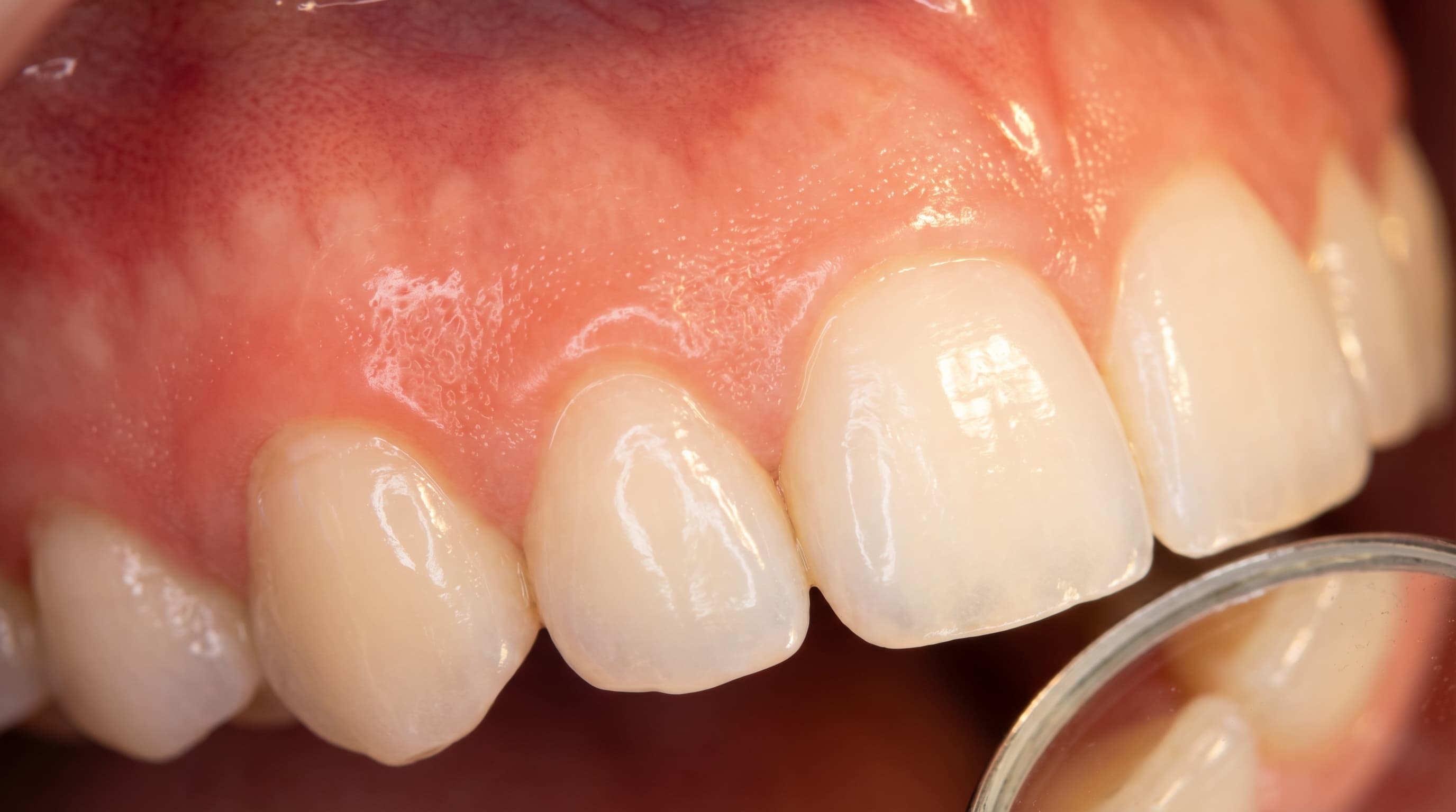 Healthy pink gums close-up