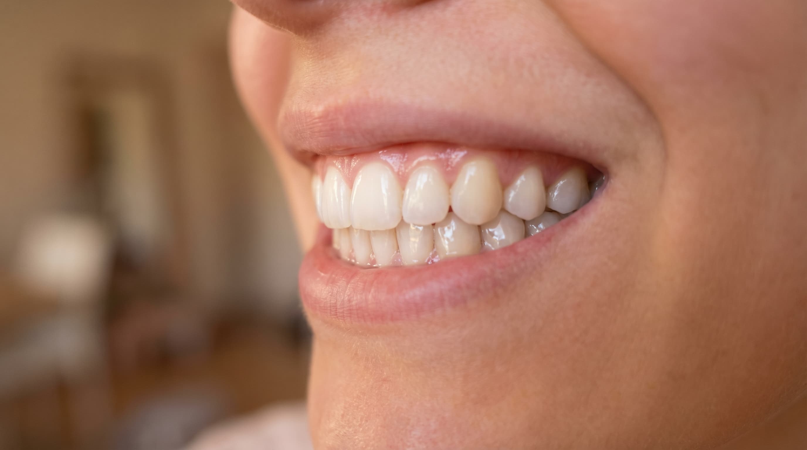 White teeth and bright smile